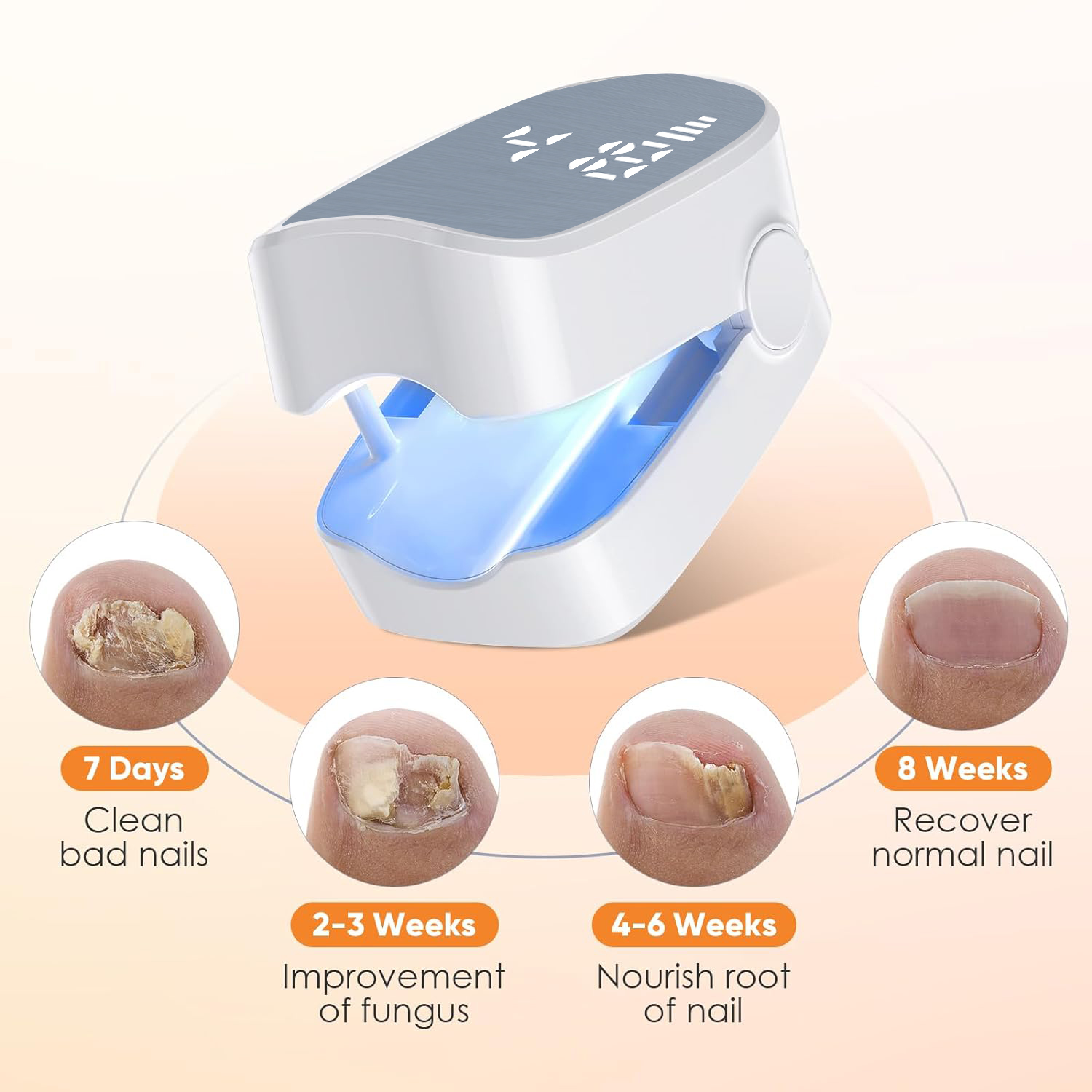 1 stücke Effektive Wiederaufla – Industrial Laser Removal Bewertung und Preis