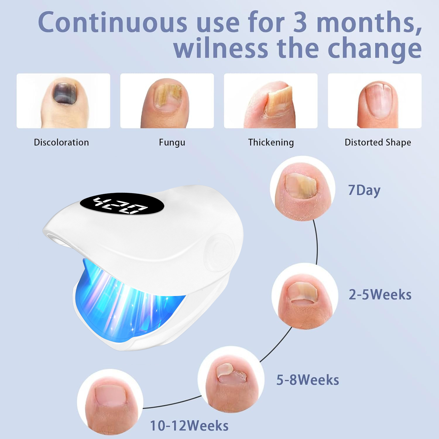 Effektive Nagelpilz-Entfernung – Industrial Laser Removal Bewertung und Preis